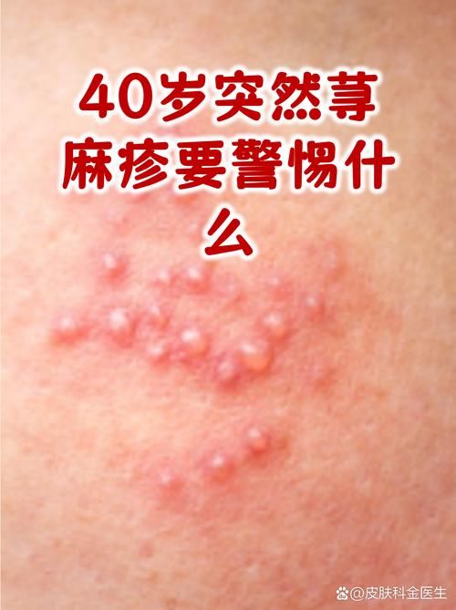 【全球新增无症状感染者8例均在广东肇庆广宁县_广东无症状感染者轨迹】