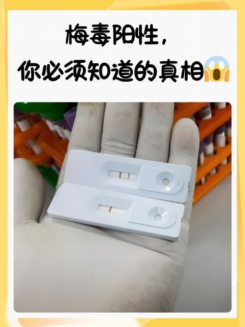 【广东省梅州市兴宁市今日核酸阳性活动轨迹,梅州兴宁新型冠状病毒】