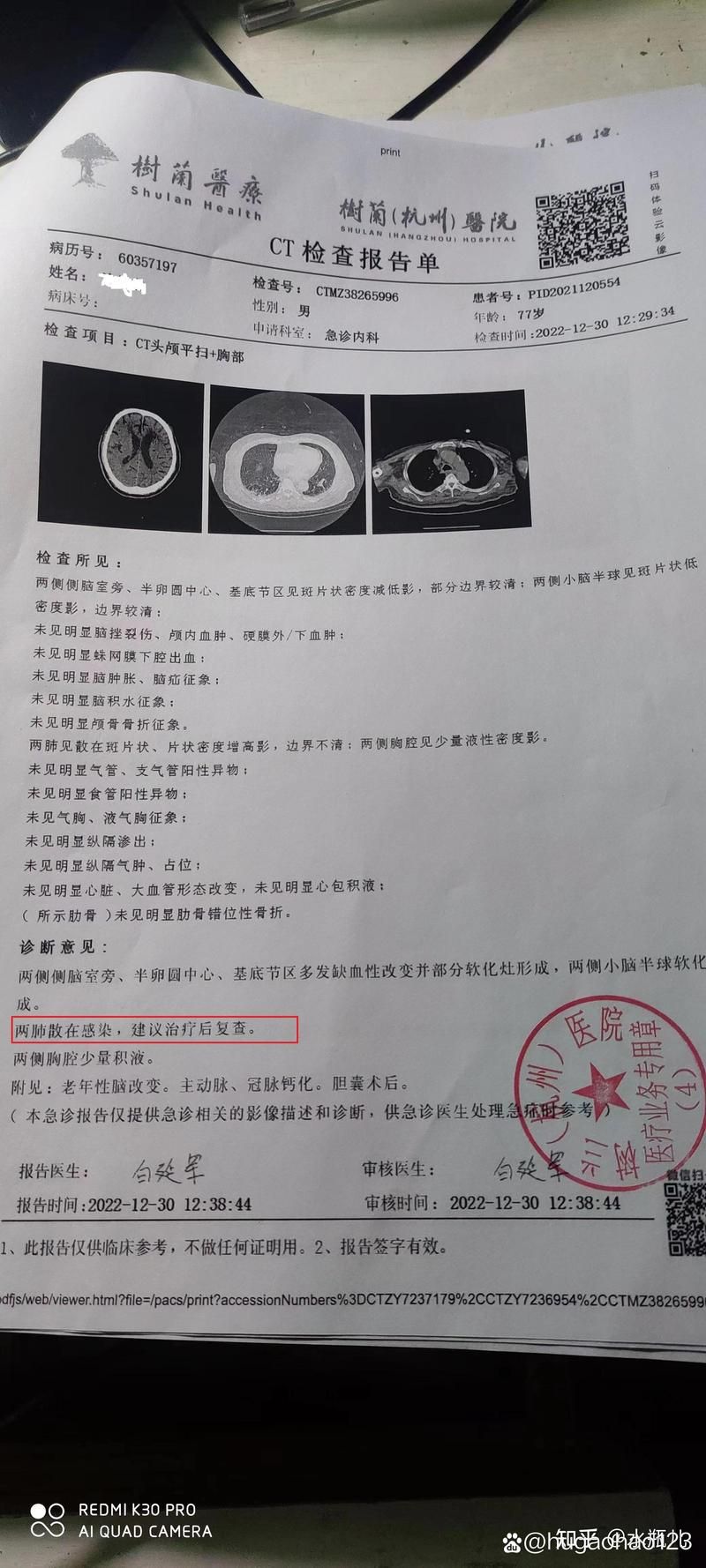 河北省邢台市清河县今冬重症病例通报_河北邢台市清河县有几例新型冠状肺炎