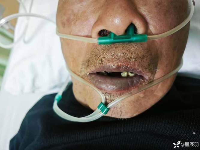 【广西壮族自治区桂林市现有无症状感染者28例,广西桂林有无新型冠状病毒感染者】