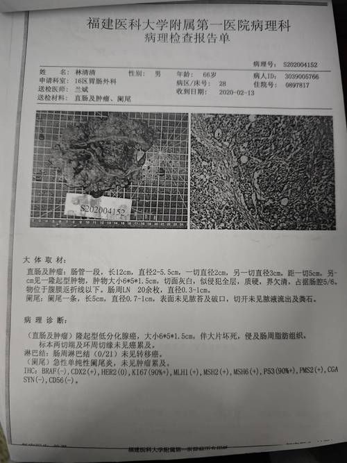 通化县累计报告死亡病例2例/通化一例病亡