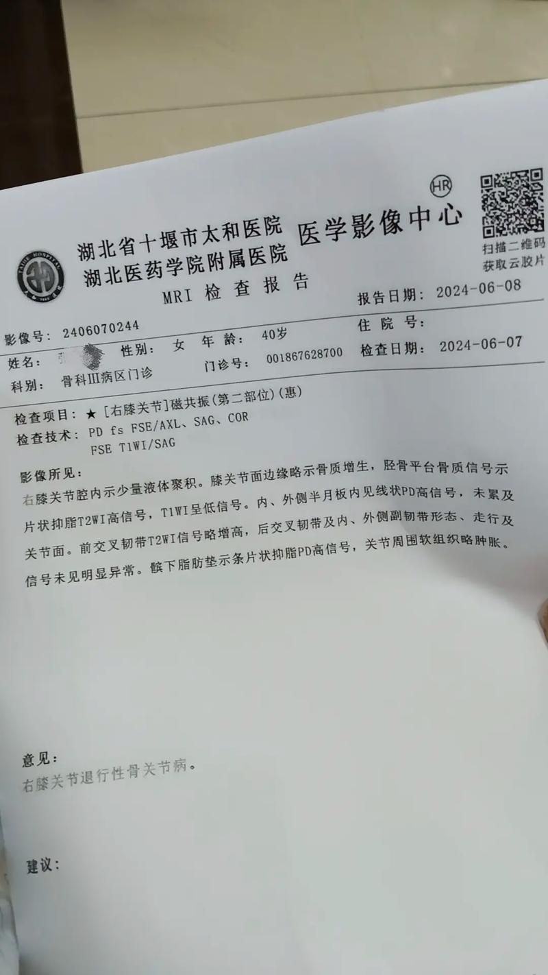 辽宁抚顺东洲区现有重症11例/抚顺出现疑似病例
