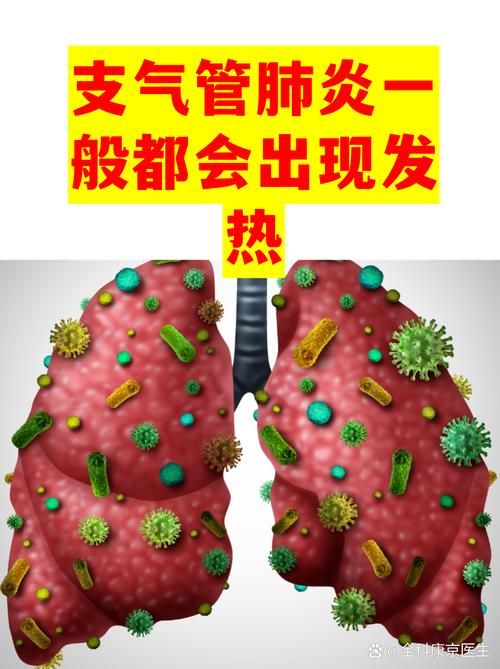 专家:内蒙古自治区呼和浩特托克托县每年或现多个感染高峰/内蒙古呼和浩特托克托县疫情