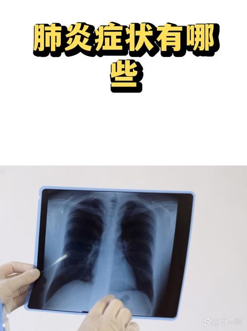 福建省泉州市永春县无症状感染者已回落9地(福建泉州永春有没有肺炎病毒感染?)