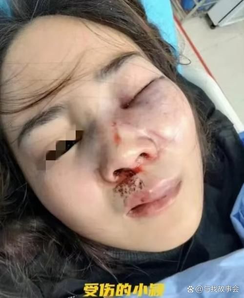 美女被咬小头头视频大全-美女被咬小头头视频大全秒懂百科V.50.67.14.70