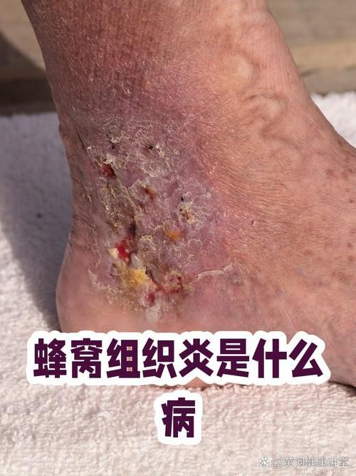 狗蜂窝组织炎苹果版/详细运营自助教程狗蜂窝组织炎V.53.13.17.69