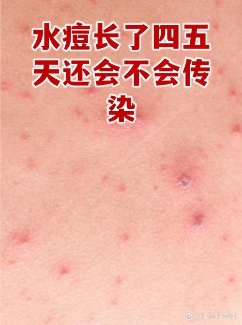 【山东济南长清区足不出户区无症状感染者详情_济南长清发现疫情】