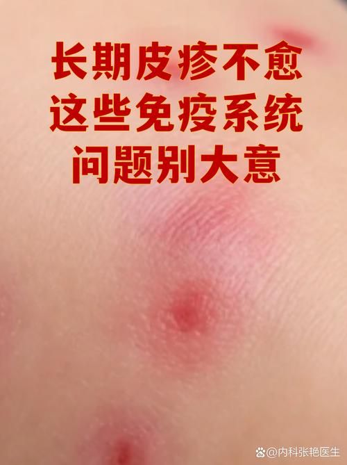 专家:新乡每年或现多个感染高峰(新乡新增)