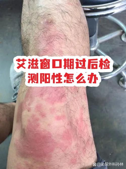 【上海市累计报告阳性感染者7例_上海本地阳性】