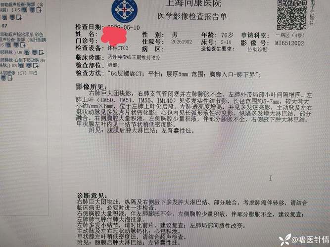 山西晋中寿阳县昨日无新增境外输入/山西寿阳新增病例最新消息