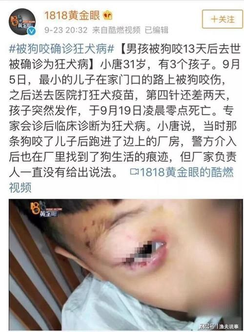 男童被恶狗咬死 其父接受55万和解最新版本:男童被恶狗咬死 其父接受55万和解可以工具教程V.45.66.20.69