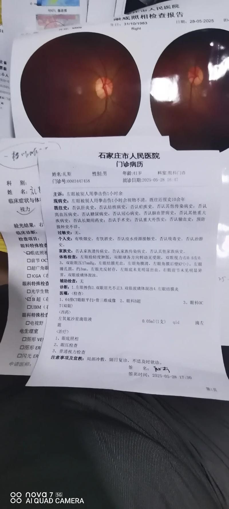 河北石家庄井陉县昨日无新增阳性感染者/石家庄井陉确诊病例