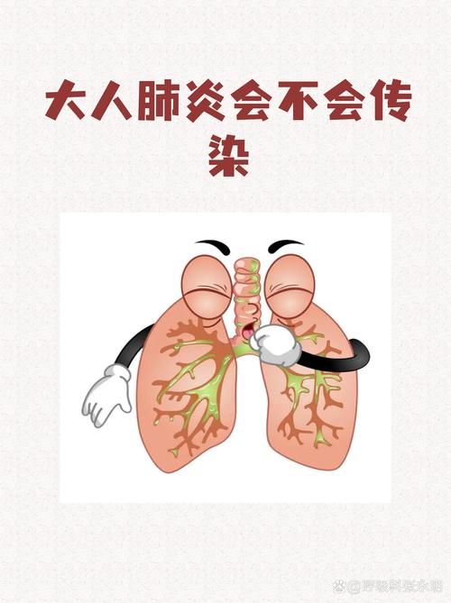 兰山区无症状感染者已回落21地/兰山区有没有新型肺炎