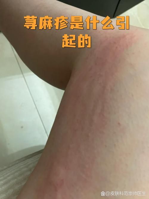 【湖北黄冈团风县现有无症状感染者14例_黄冈团风县连续几天无新增】