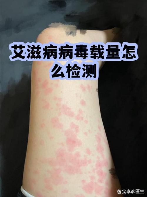 山东淄博现有核酸阳性12例(淄博感染者)