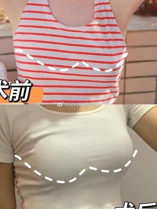 那种丰胸效果好:了解平台那种丰胸效果好