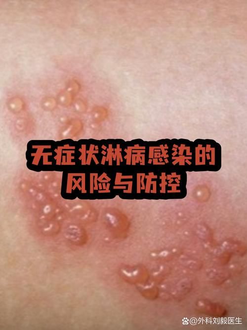 全国新增无症状感染者8例:全国新增无症状感染者8例