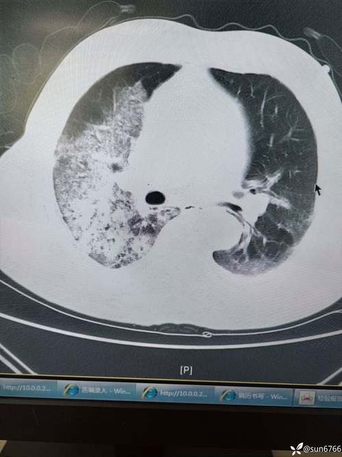 湖北荆门掇刀区今日新增6例境外输入病例_荆门市掇刀区新型肺炎